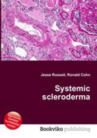 Systemic scleroderma
