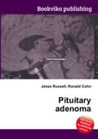 Pituitary adenoma