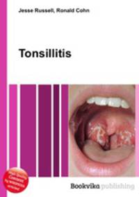 Tonsillitis