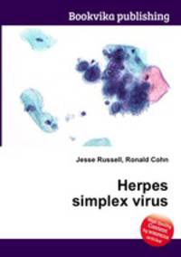 Herpes simplex virus