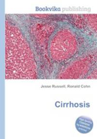 Cirrhosis