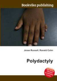 Polydactyly