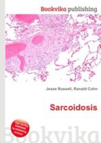 Sarcoidosis