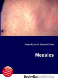 Measles