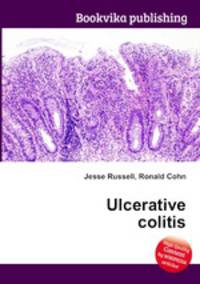 Ulcerative colitis