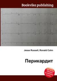 Перикардит