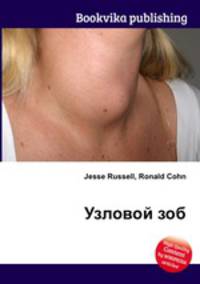 Узловой зоб