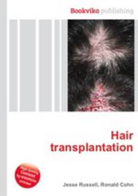 Hair transplantation