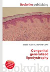 Congenital generalized lipodystrophy