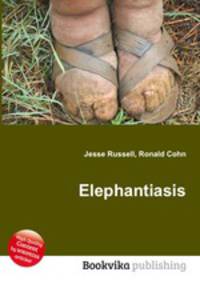 Elephantiasis