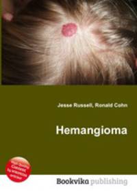 Hemangioma