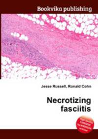 Necrotizing fasciitis