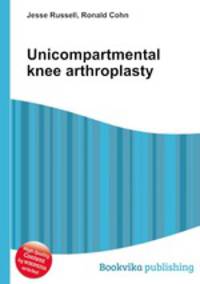 Unicompartmental knee arthroplasty