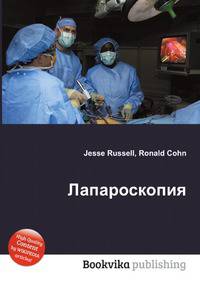 Лапароскопия