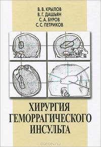 Хирургия геморрагического инсульта