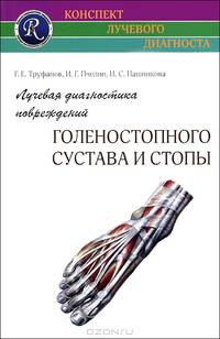 Лучевая диагностика повреждений голеностопного сустава и стопы . (Конспект лучевого диагноста)