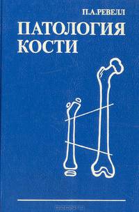 Патология кости