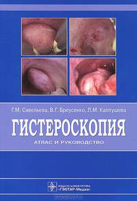 Гистероскопия : атлас и руководство