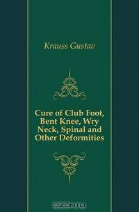 Cure of Club Foot, Bent Knee, Wry Neck, Spinal and Other Deformities