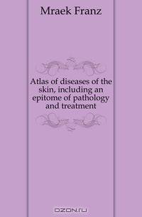 Atlas of diseases of the skin, including an epitome of pathology and treatment