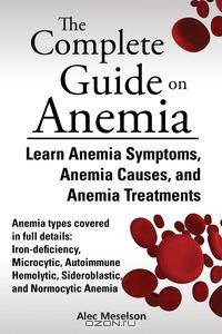 The Complete Guide on Anemia. Learn Anemia Symptoms, Anemia Causes, and Anemia Treatments. Anemia types covered in full details: Iron-deficiency, Microcytic, Autoimmune Hemolytic, Sideroblastic, and Normocytic Anemia