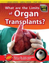 What Are the Limits of Organ Transplantation? (Sci-Hi: Science Issues)