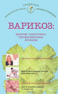 Варикоз. Ранние симптомы, профилактика, лечение