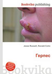 Герпес