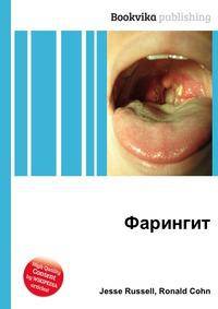 Фарингит