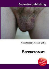 Вазэктомия