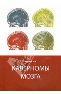 Каверномы мозга