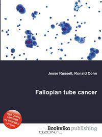 Fallopian tube cancer