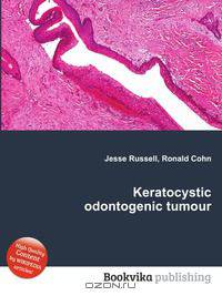 Keratocystic odontogenic tumour