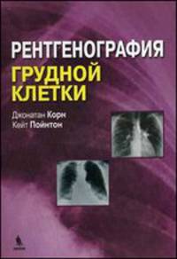 Рентгенография грудной клетки