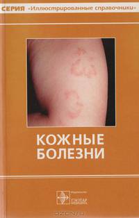 Кожные болезни
