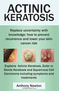 Actinic Keratosis. Replace the fear and uncertainty with knowledge