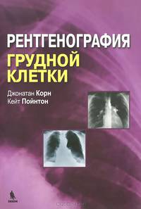 Рентгенография грудной клетки