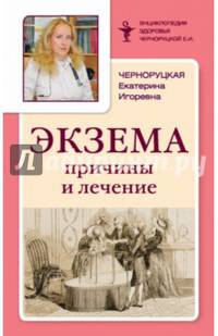Экзема. Причины и лечение
