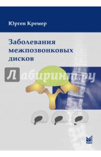 Заболевания межпозвонковых дисков