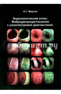 Эндоскопический атлас. Фиброуретроцистоскопия с узкоспектровой диагностикой