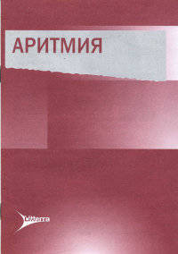 Аритмия