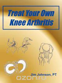 Treat Your Own Knee Arthritis