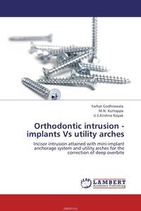 Orthodontic intrusion - implants Vs utility arches