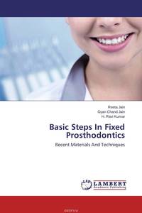 Basic Steps In Fixed Prosthodontics