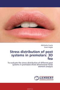 Stress distribution of post systems in premolars: 3D fea