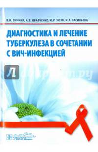 Диагностика и лечение туберкулеза в сочетании с ВИЧ-инфекцией