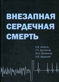 Внезапная сердечная смерть