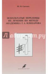 Оскольчатые переломы. Их лечение по методу академика Г. А. Илизарова. Монография