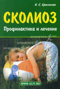 Сколиоз: Профилактика и лечение