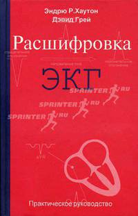 Расшифровка ЭКГ